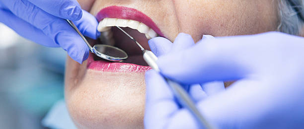 Best Dentist Open on Weekends  in Stratford, TX
